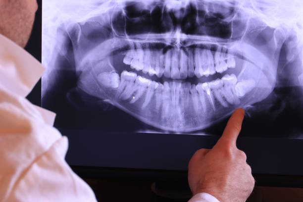 Best Emergency Denture Repair in USA